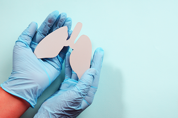 Cáncer de pulmón: síntomas y factores de riesgo